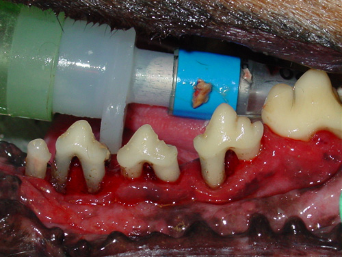 Periodontics